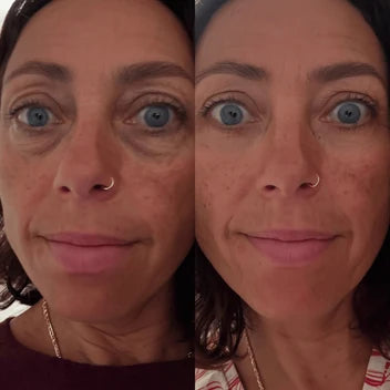 LumiRise Pro™