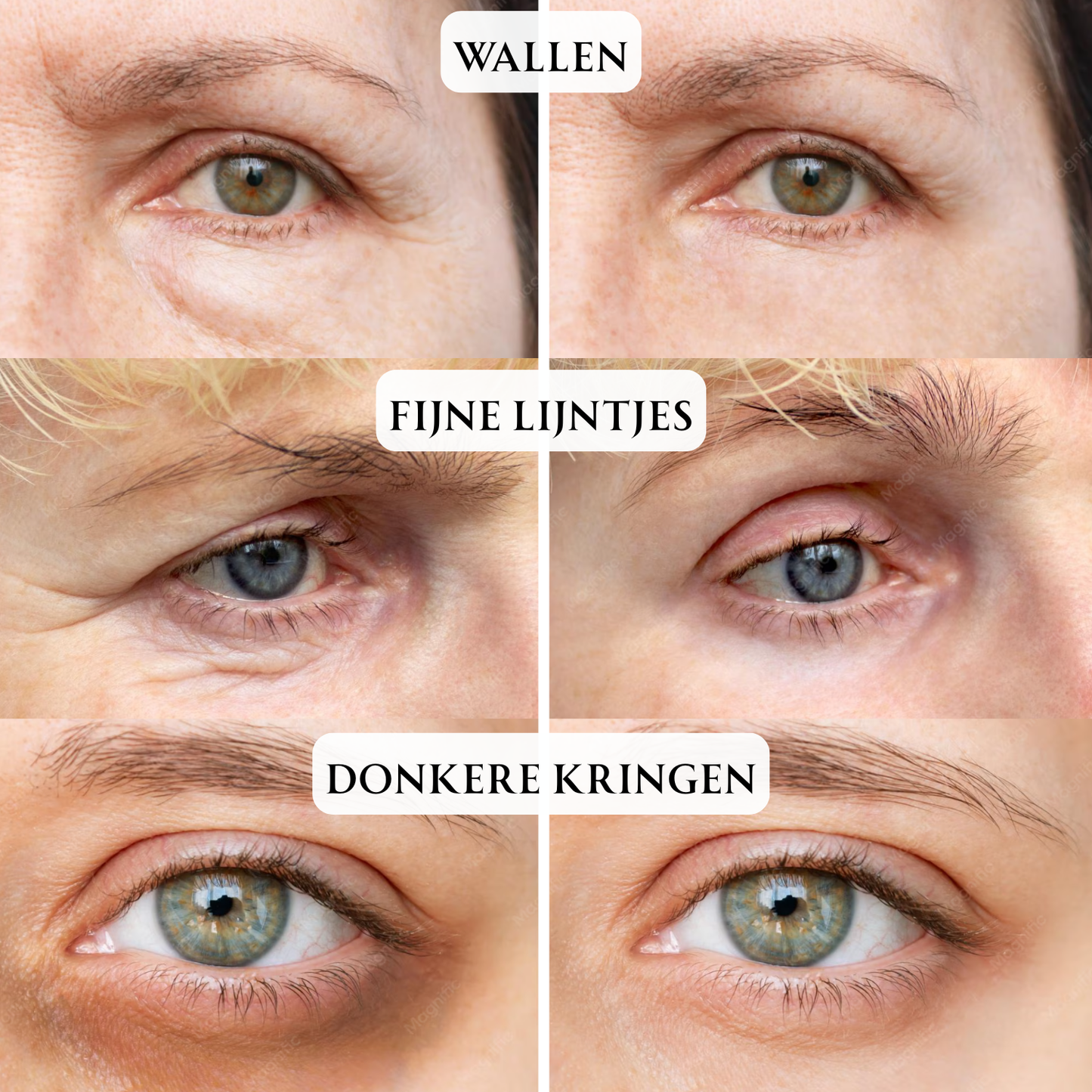 LumiRise Pro™ EYE MASSAGER