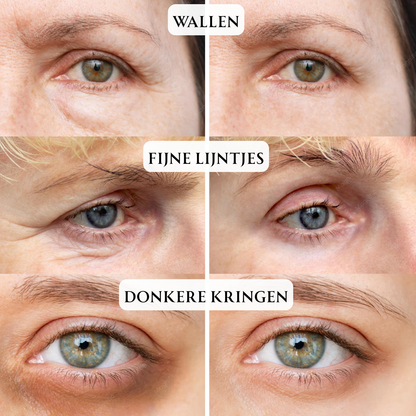 LumiRise Pro™ EYE MASSAGER